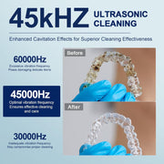 🦷Ultrasonic Dental Cleaner – Deep Clean Your Retainers & Dentures with Ease ✨